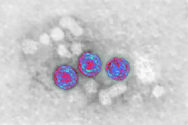 ماهرین وايي، تور او سپین زیړی یوه ساري ناروغي ده. ارشیف تصویر
