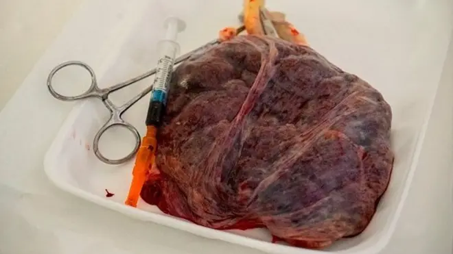 Aworan olubi ọmọ