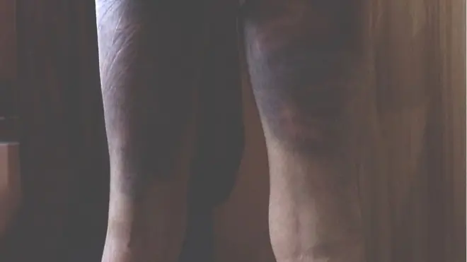 Miilla isaa duubaan nama dararamuu isaa agarsiise