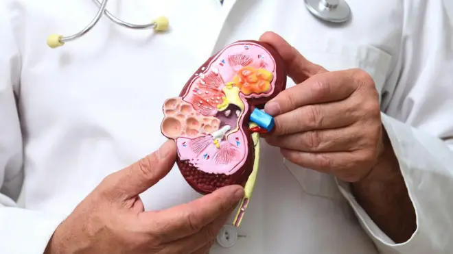 किडली स्टोन