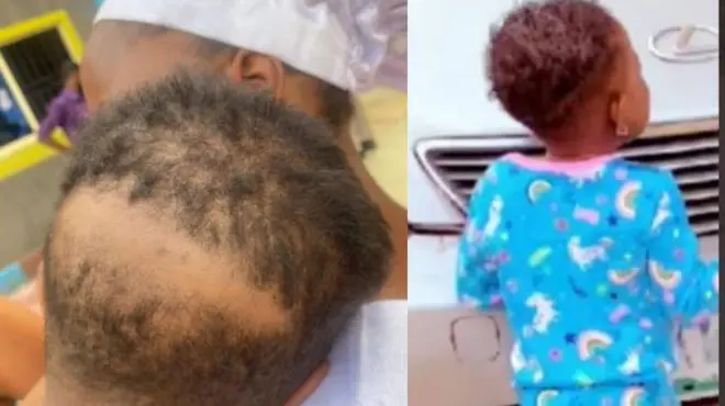 Ọmọ ti wọn fa irun rẹ