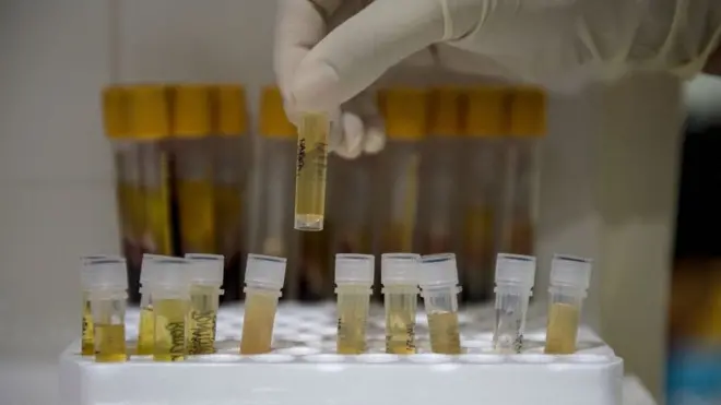 Nurse wey dey hold test container