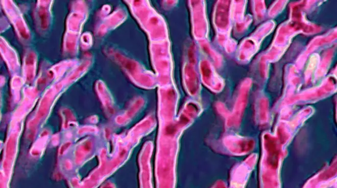 煙曲菌，一種會導致人類和鳥類嚴重感染的真菌