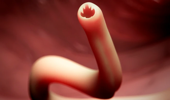 ภาพจำลองพยาธิปากขอในลำไส้