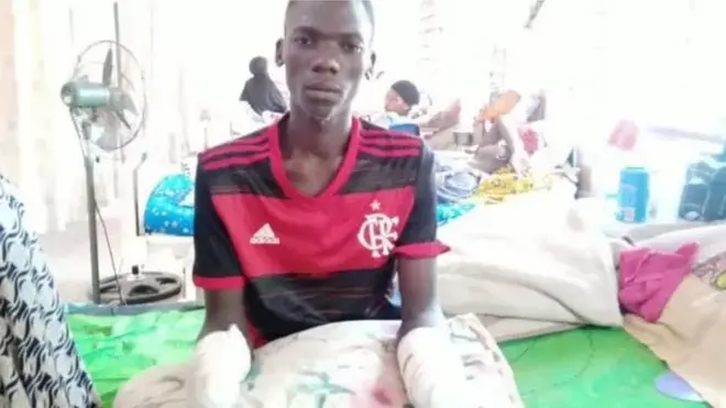 Yahaya Galadima nileewosan to ti n gba itju nilu Lafia yin ikọlu to gba ọwọ rẹ mejeeji