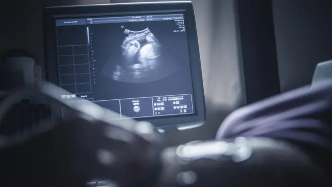 प्रातिनिधिक फोटो