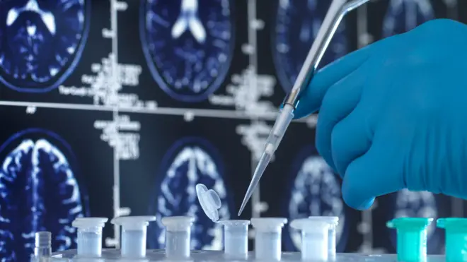 deney tüpüne şırınga enjekte eden eldivenli bir el ve arka planda beyin emar tarama görüntüleri