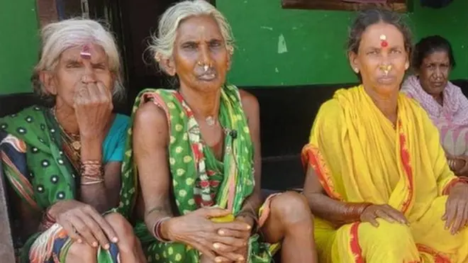 ఉద్ధానంం ప్రాంతంలో దాదాపు లక్షమంది జనాభాలో 35 శాతం మంది కిడ్నీ వ్యాధిగ్రస్తులే