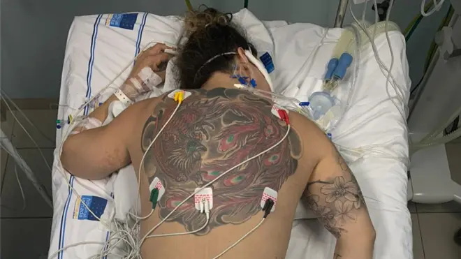 उपचारका क्रममा र्‍यालेक ट्रिभिजी