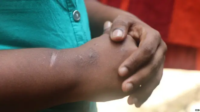 මත්ද්රව්ය භාවිතය