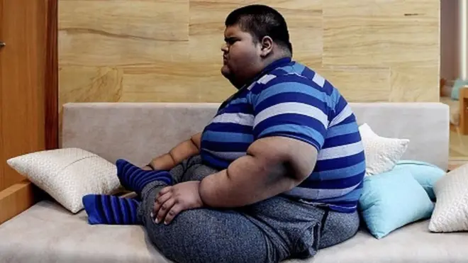 After weeks of treatment and a gastric bypass surgery, 14-year-old Mihir Jain's weight came down to 165kg from 237kg