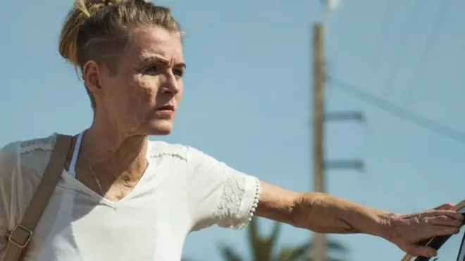 Si bien Vicky Knight tiene cicatrices reales en su cuerpo, ella usó una prótesis en su cara para la película "Dirty God".