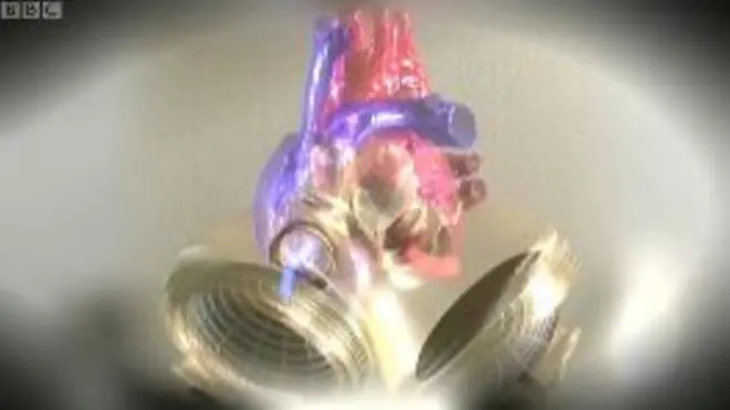 У Сельви Хуссейн - ось таке штучне серце