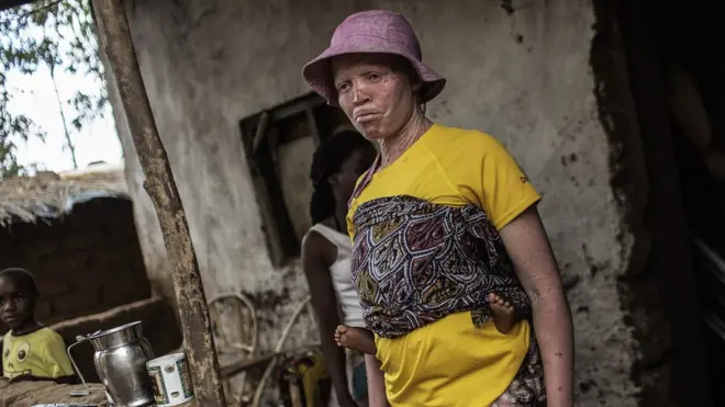 Ms Tchulani say she still dey get bad dreams about wetin happen.