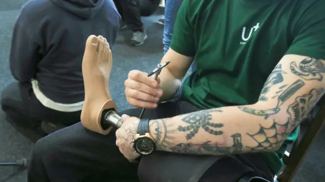 людина, протез