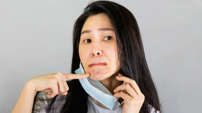 كيف نتخلص من حب الشباب الناتج عن ارتداء الكمامات