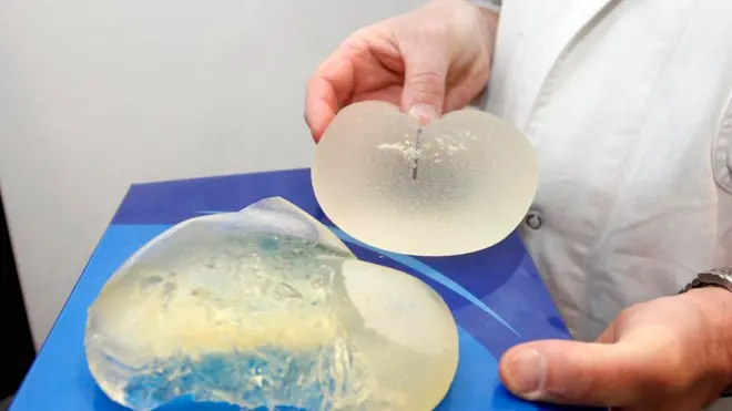 قواعد الشرطة الألمانية تمنع التحاق ذات الثديين الصناعيين بالشرطة