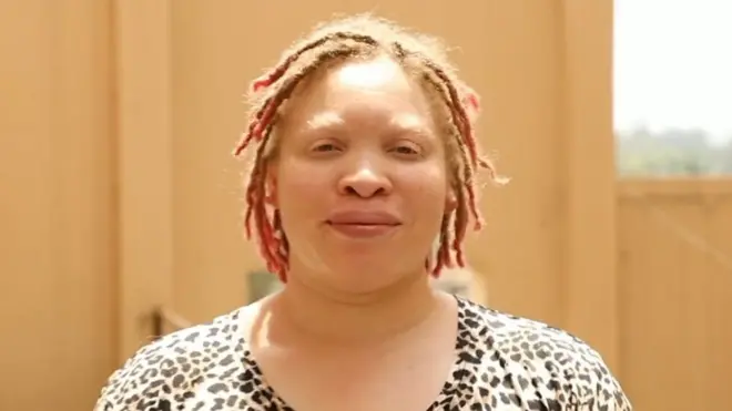 “ارتفاع درجات الحرارة يعرضني للأذى”