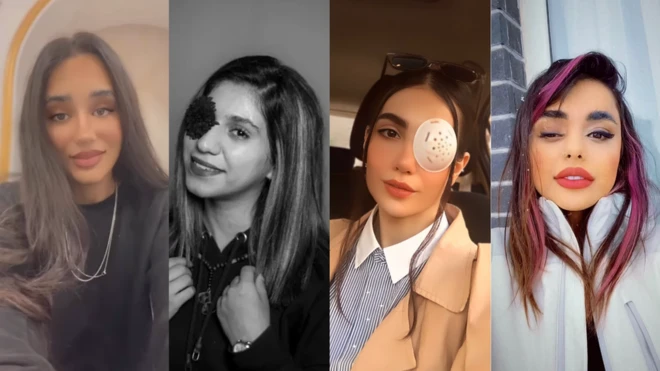 عکس دخترانی که آسیب چشمی دیده اند