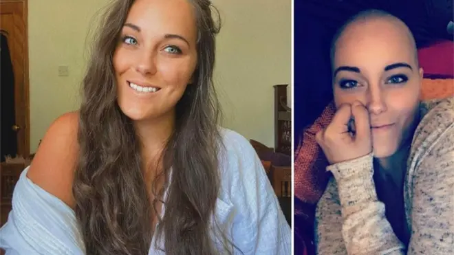 Emily Frost didiagnosa kanker payudara yang menyebar ke kelenjar getah bening