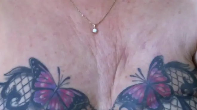 Dubartiin akkoo taatettu kun, kaansariin erga harmii ishii muramee booda tumaa qabduu harmaa tumachuun jireenyakoo geddare jetti.