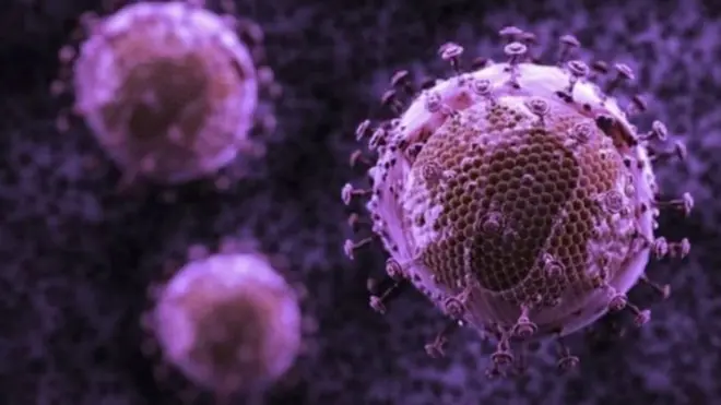 فيروس الإيدز