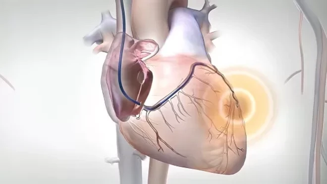 Kidney graphic