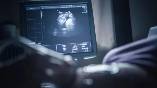 సోనోగ్రఫీ ఫోటో 