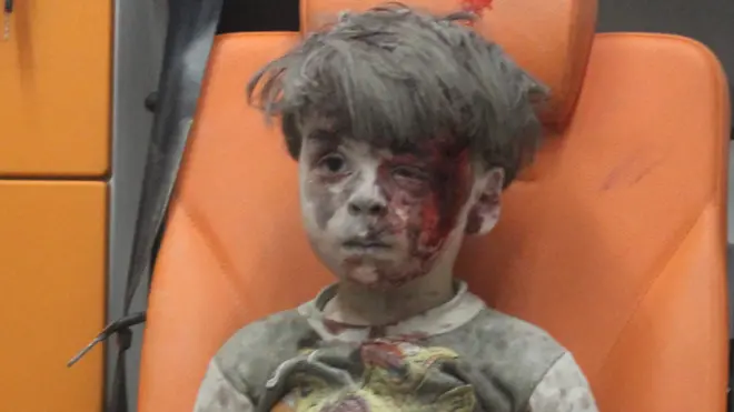 Omran Daqneesh, 17 Aug 16