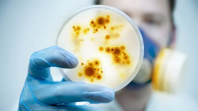 Placa con un cultivo.