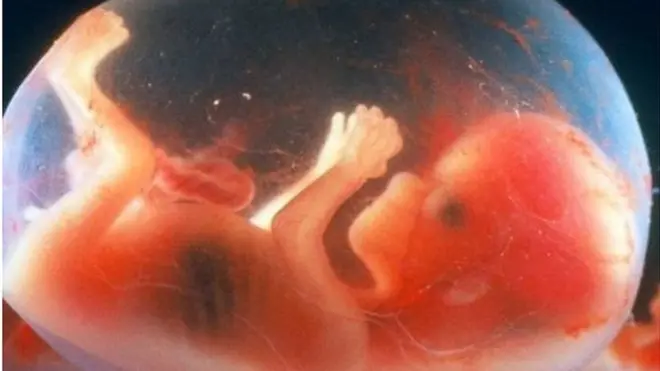 14 వారాల పిండం