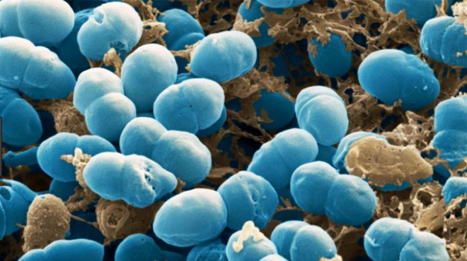 เชื้อแบคทีเรีย Staphylococcus epidermidis จำนวนมาก อาศัยอยู่บนผิวหนังของมนุษย์ทุกคน