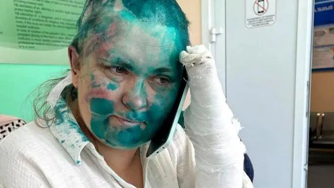 الصحفية إيلينا ميلاشينا 