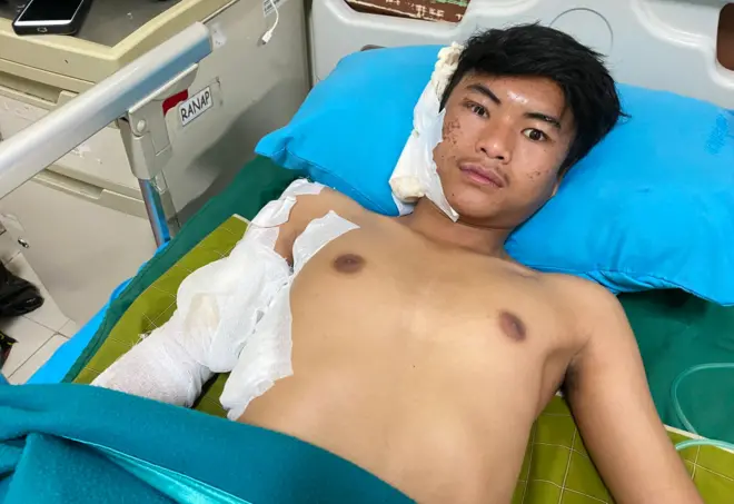 Suryadi Maryana, korban tumpahan soda api di Bandung Barat, dirawat di RSUD Cikalongwetan, Rabu (25/12).