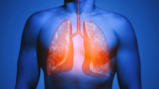 Ilustração de tórax com pulmões destacados