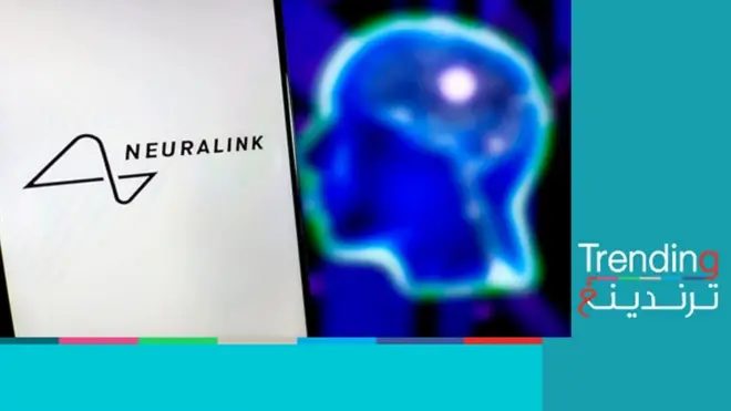 زراعة شريحة إليكترونية في دماغ إنسان