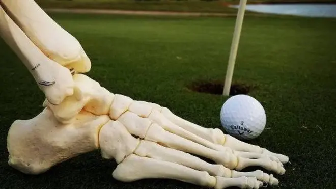 Mfupa wa mguu wa Kristi Loyall