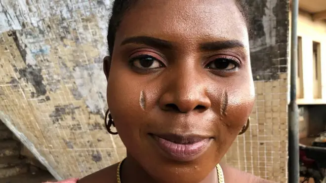 A woman with scars on her face