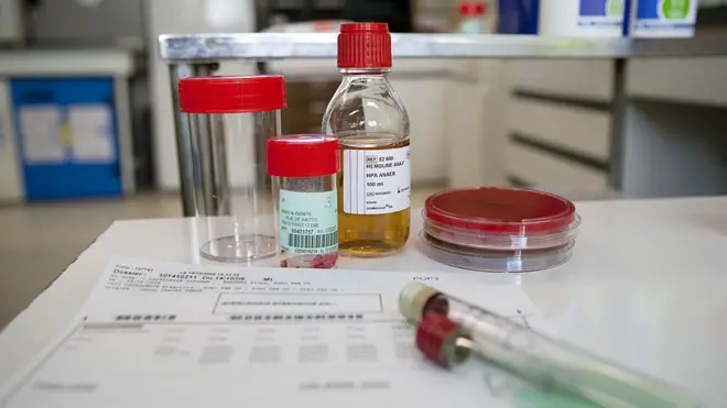 Tuberculosis, akpụka nti, ụkwara nta na ọrịa ndị ọzọ ị nwereike ikute n'ume