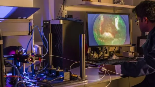 مسبار الرئة