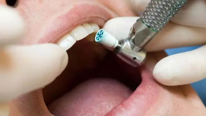 Un persona a la que le están practicando un tratamiento dental