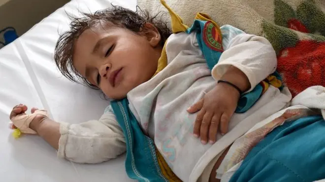 Comité Internacional de la Cruz Roja asegura que el número de infectados por cólera en Yemen se multiplica día a día.