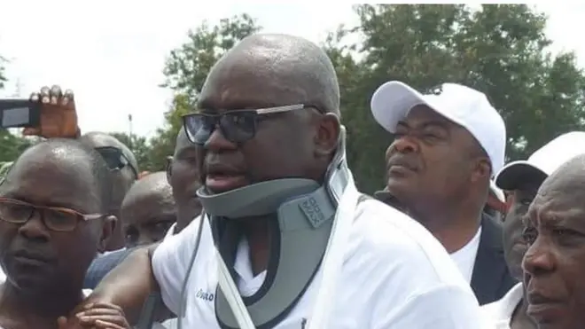 Governor Ayo Fayose claim say dem throw tear gas for im eyes.