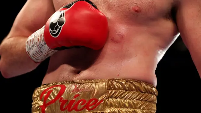 Клеймо победителя на животе британца Прайса