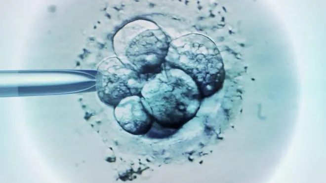Una fecundación in vitro