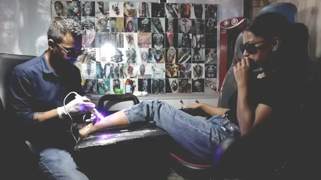 लेजरको प्रयोगले ट्याटु मेटाउँदै।