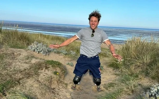 Shaun Whiter a été amputé des jambes après avoir été renversé par un conducteur en état d'ébriété, mais il est déterminé à tirer le meilleur parti de sa situation.