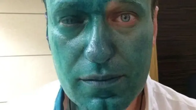 Алексей Навальный