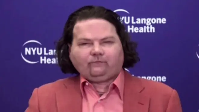 Лікарі не поспішали з остаточним оголошенням успіху операції, щоб обличчя та дві руки точно прижилися