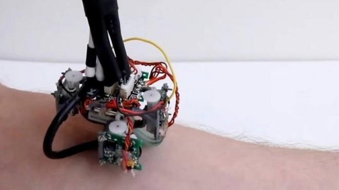 Робот может автономно обследовать тело человека.